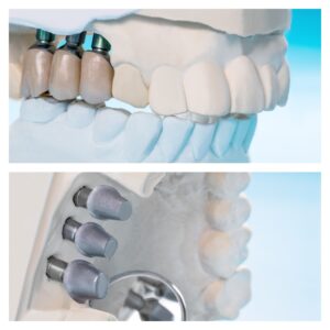 MixCollage-17-Jul-2025-11-48-AM-