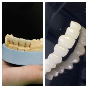 MixCollage-17-Jul-2025-11-52-AM-