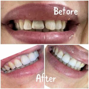 WhatsApp Image 2025-07-17 at 10.31.36 PM (1)