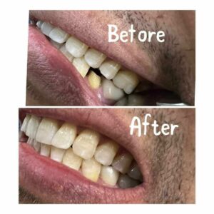 WhatsApp Image 2025-07-17 at 10.31.36 PM (3)