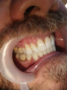 WhatsApp Image 2025-07-17 at 10.31.36 PM (6)